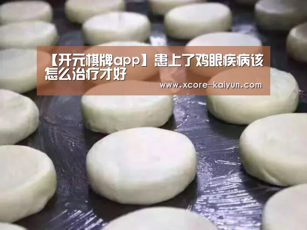 【开元棋牌app】患上了鸡眼疾病该怎么治疗才好(图2) 开元棋牌官网